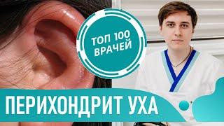 Перихондрит уха: симптомы и лечение. Воспаление ушной раковины, что делать