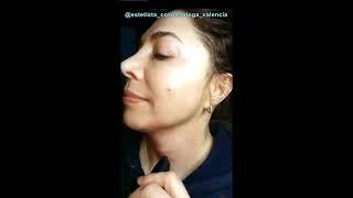 Beauty Monster Black (with Plasma tip) - Wrinkle of neck