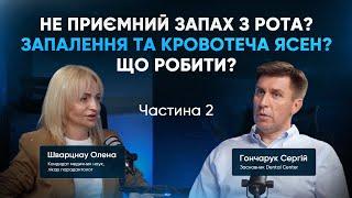 Не приємний запах з рота? Запалення та кровотеча ясен? Що робити? | ЧАСТИНА 2 | DENTAL CENTER