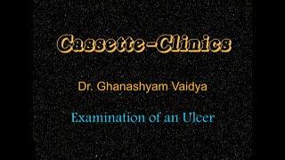 CS02_Examination of an Ulcer.  Video Film by Dr. Ghanashyam Vaidya