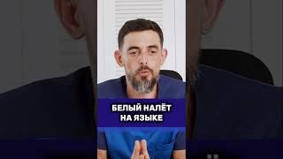 Белый налёт на языке