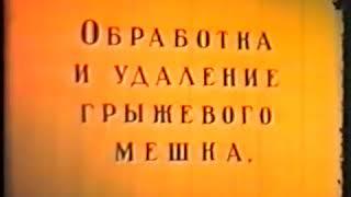 Паховая грыжа  Учебный фильм