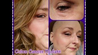 Colon Cancer Update Wig Fitting Experience