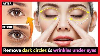 Brighter eyes quickly! Remove dark circles under eyes & wrinkles under eyes naturally | Eyes massage