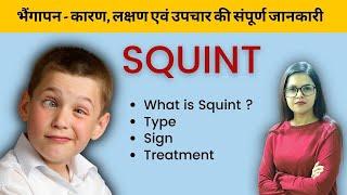 Squint | भैंगापन - कारण, लक्षण एवं उपचार | Bhushan Science Online Classes