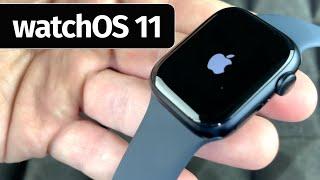 How to Update Apple Watch to watchOS 11 | Latest Apple Watch Software Update 2024