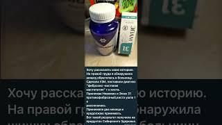 МАСТОПАТИЯ ЛЕЧИТСЯ #siberianwellness #мастопатия #бадыдляздоровья #шишка