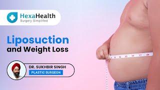 Can you lose weight with Liposuction? | | HexaHealth Expert