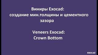 Виниры Exocad:2)Создание мин. толщины и цементного зазора в Exocad / Veneers Exocad:2) Crown Bottom