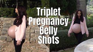 Triplet Pregnancy Belly Shots