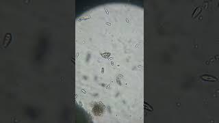 Beach season with the micro cosmos! #microorganism #paramecium #algae #beach #saltwater