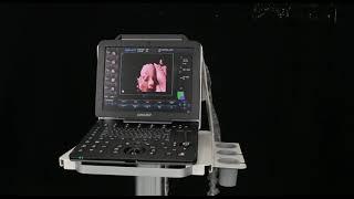 DW P5PRO Baby color doppler ultrasound system
