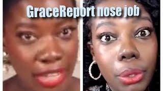 Grace report nose job ?