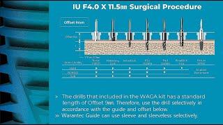 [warantec] Warantec’s Clinical Surgery Video with Digital Guide