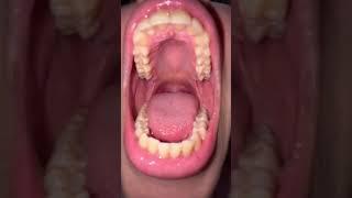 beautiful mouth view