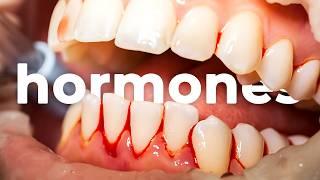 Hormonal Imbalance Ruining Your Teeth? Here's How to Fix It