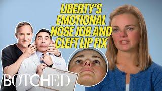 Liberty's Cleft Lip & Botched Nose Job FIXED By Doctors (Before & After) | Botched | E!