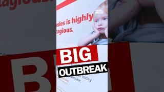 Measles Outbreak 