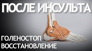 Восстановление голеностопа после инсульта. Подготовительные упражнения.