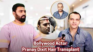 Bollywood Actor Pranay Dixit Hair Transplant | Celebrity Hair Transplant in india