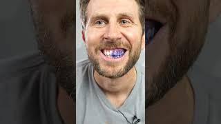 Purple Teeth Scam