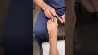 Corrective Bunion Taping