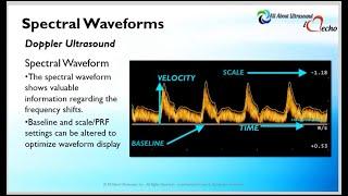 Doppler Principles - Spectral Analysis