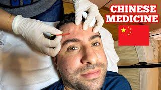 AMERICAN Tries CHINESE Medicine in China! IS IT WORTH IT? 