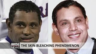 THE SKIN BLEACHING PHENOMENON