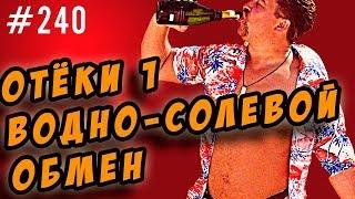 отёки.водно солевой обмен