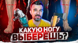 Какую ногу отрезать? / АНТИЖАЛОСТЬ