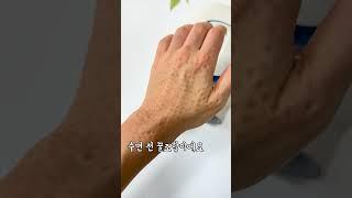 손마사지기 손등 손가락 케어 비브아