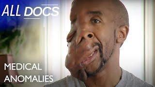 Maurice's Brand New FACE | S01 E01 | Extraordinary People Documentary | All Documentary