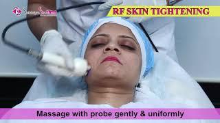 Radio Frequency  (RF) Skin Tightening    |    Sakhiya Skin Clinic