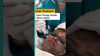 Get Instant Glow with Carbon Laser Facial Treatment at SkinQure | Skincare Solution