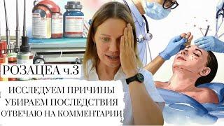 РОЗАЦЕА ЧАСТЬ 3 || ИЗЛЕЧИМА? ОТВЕЧАЮ НА КОММЕНТАРИИ, ПРИВОЖУ ПРИМЕРЫ || УПРАЖНЕНИЕ В КОНЦЕ ВИДЕО