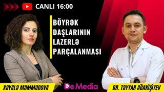 BÖYRƏK DAŞLARININ LAZERLƏ PARÇALANMASI - CANLI YAYIM - PEŞƏKAR HƏKİMLƏR