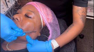 Learn Dermaplaning W/ Me + Juicy Extractions 