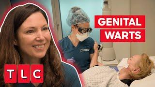 Dr. Emma Uses Lasers To Help A Woman With Genital Warts | The Bad Skin Clinic