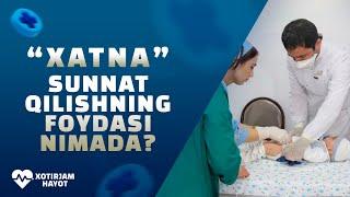 XATNA - SUNNAT QILISHNING FOYDASI NIMADA?