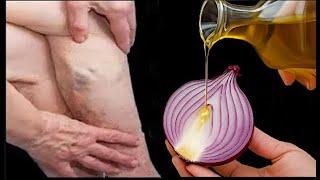 Leg Pain. Rheumatism, varicose veins cramps arthritis, Joint PAIN. In 3 Days. This plant