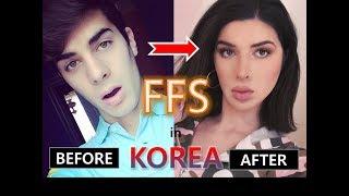 Top 10 Most dramatic FFS transformations!!