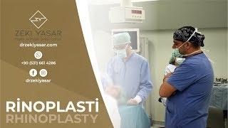 Rinoplasti / Rhinoplasty Op. Dr. Zeki Yaşar