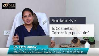 Corrective Eye Surgery to treat Sunken Eye - Explained by Dr.Priti Udhay