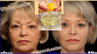 90 years old grandma use this to look 30 years younger in 5 days Tighten skin on face naturally