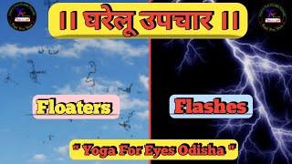 Treatment of Eye Floaters and Flashes ।। Yoga For Eyes by Dr. Gourishankar Goswami ।।