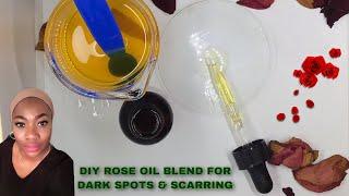 HOW TO MAKE LIGHTENING ROSE OIL BLEND FOR DARK SPOTS & THE COST OF PRODUCTION.