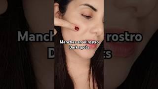 #manchasenlapiel #manchasfaciales #darkspots  @ooznary_official #kbeauty #koreanskincare