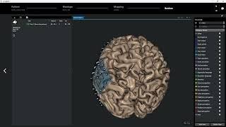 cortiQ 2.0 - EXPRESSIVE LANGUAGE MAPPING