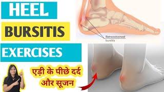 Heel bursitis exercises | Retrocalcaneal bursitis | एड़ी के पीछे दर्द